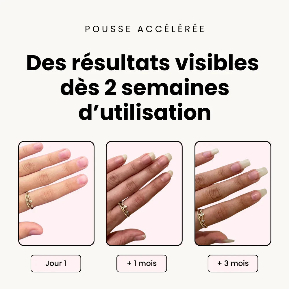 gel nail strip removal